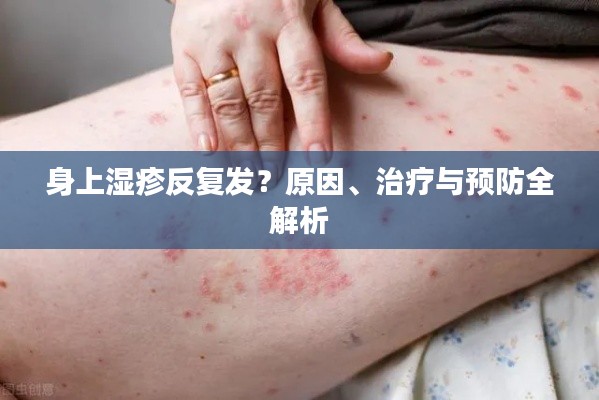 身上湿疹反复发？原因、治疗与预防全解析